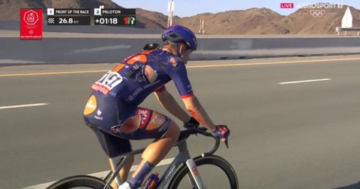 🎥 Fabio Jakobsen gives quick update after nasty crash in UAE Tour