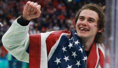 Spittin' chiclets: What happens when hockey players lose their teeth?