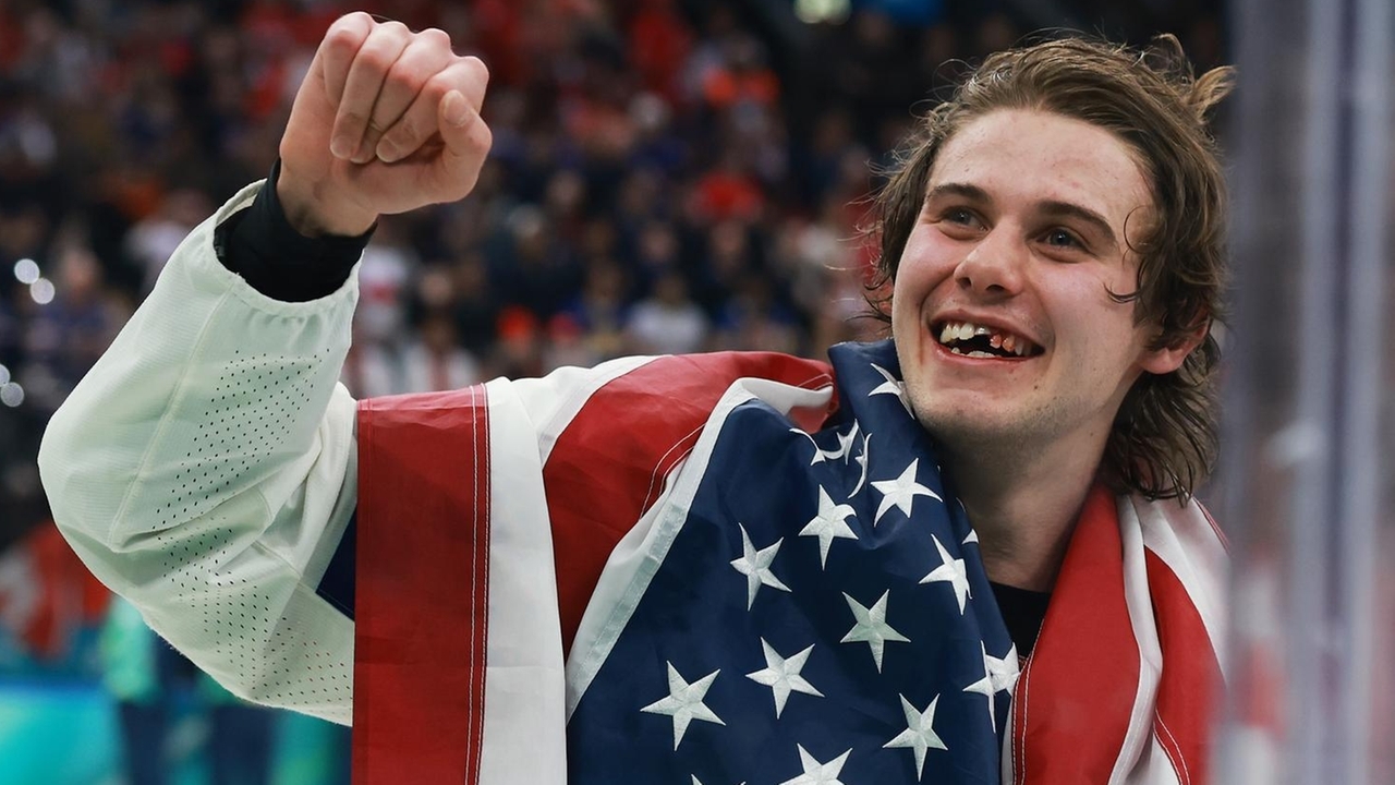 Spittin' chiclets: What happens when hockey players lose their teeth?