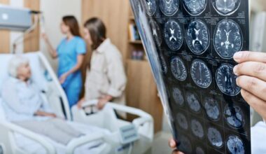 NIH Halts Stroke Treatment Trial Arm