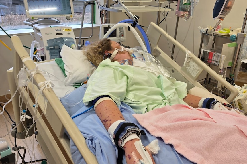 A woman with blonde hair lies in a hospital bed, with life support tubes and cords around her body.