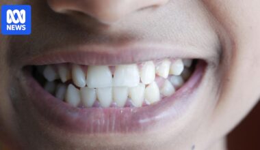 What our teeth reveal about the growing gap between rich and poor