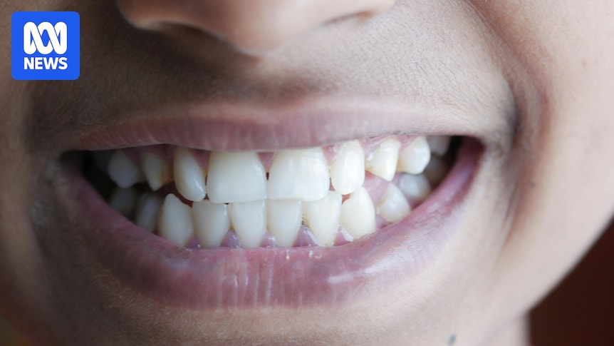 What our teeth reveal about the growing gap between rich and poor