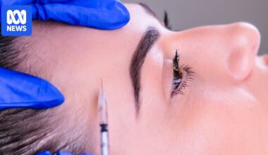 Cheaper, easier and less taboo: Why more gen Zs are getting cosmetic injectables such as botox