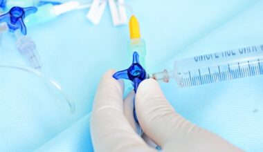 Moderate exercise lowers atrial fibrillation recurrence after ablation