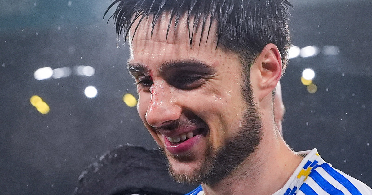 Gruev earns Hisense Player of the Match after starring role in Forest win