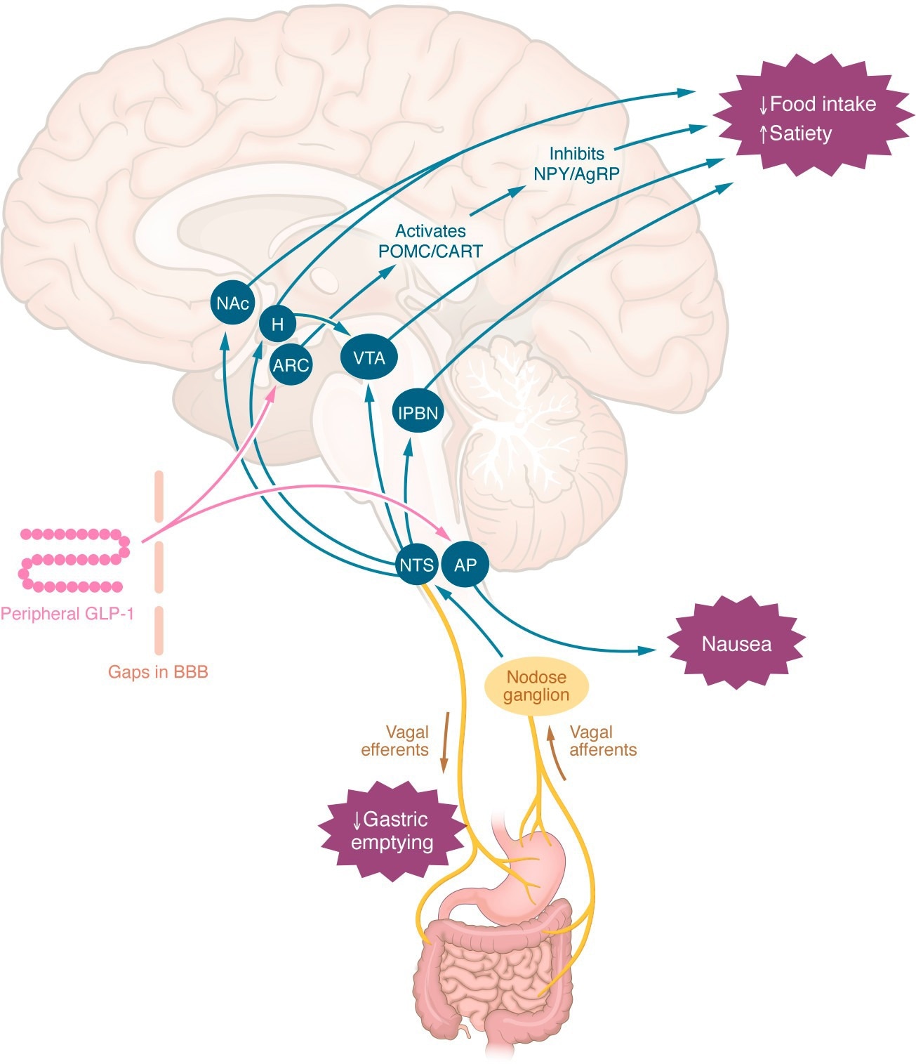 Central mechanisms by which peripheral GLP-1RAs may reduce appetite or induce nausea. Peripheral GLP-1 or GLP-1RAs may interact with appetite-regulating regions of the brain via gaps in the blood-brain barrier, via tanycyte uptake, or indirectly via the nodose ganglia. The effects to slow gastric emptying, induce nausea, and reduce energy intake are independent. AgRP, agouti-related peptide; AP, area postrema; ARC, arcuate nucleus; BBB, blood-brain barrier; CART, cocaine- and amphetamine-regulated transcript; H, hypothalamus; lPBN, lateral parabrachial nucleus; NAc, nucleus accumbens; NPY, neuropeptide Y; NTS, nucleus tractus solitarius; POMC, proopiomelanocortin; VTA, ventral tegmental area.