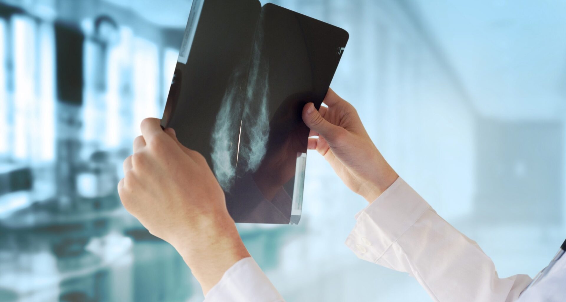 Study: Individualized mRNA vaccines evoke durable T cell immunity in adjuvant TNBC. Image Credit: Guschenkova / Shutterstock