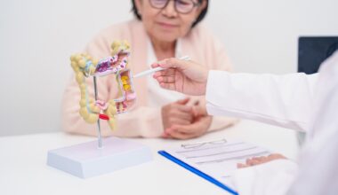 Older adult female patient consultation with doctor. Doctor is pointing to model of colon