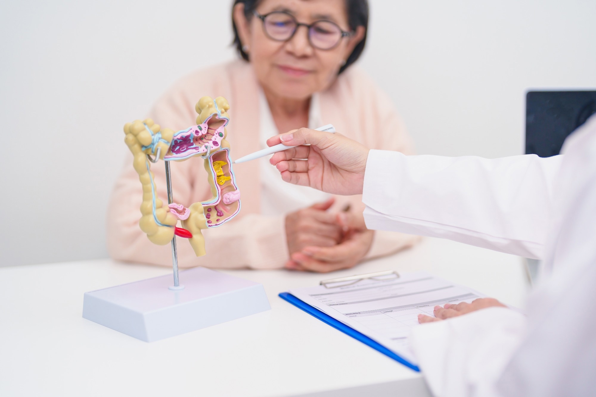 Older adult female patient consultation with doctor. Doctor is pointing to model of colon