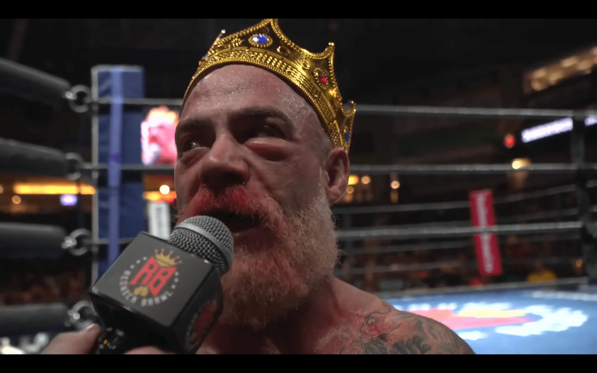 Vanilla Gorilla showing the telltale signs of a broken nose