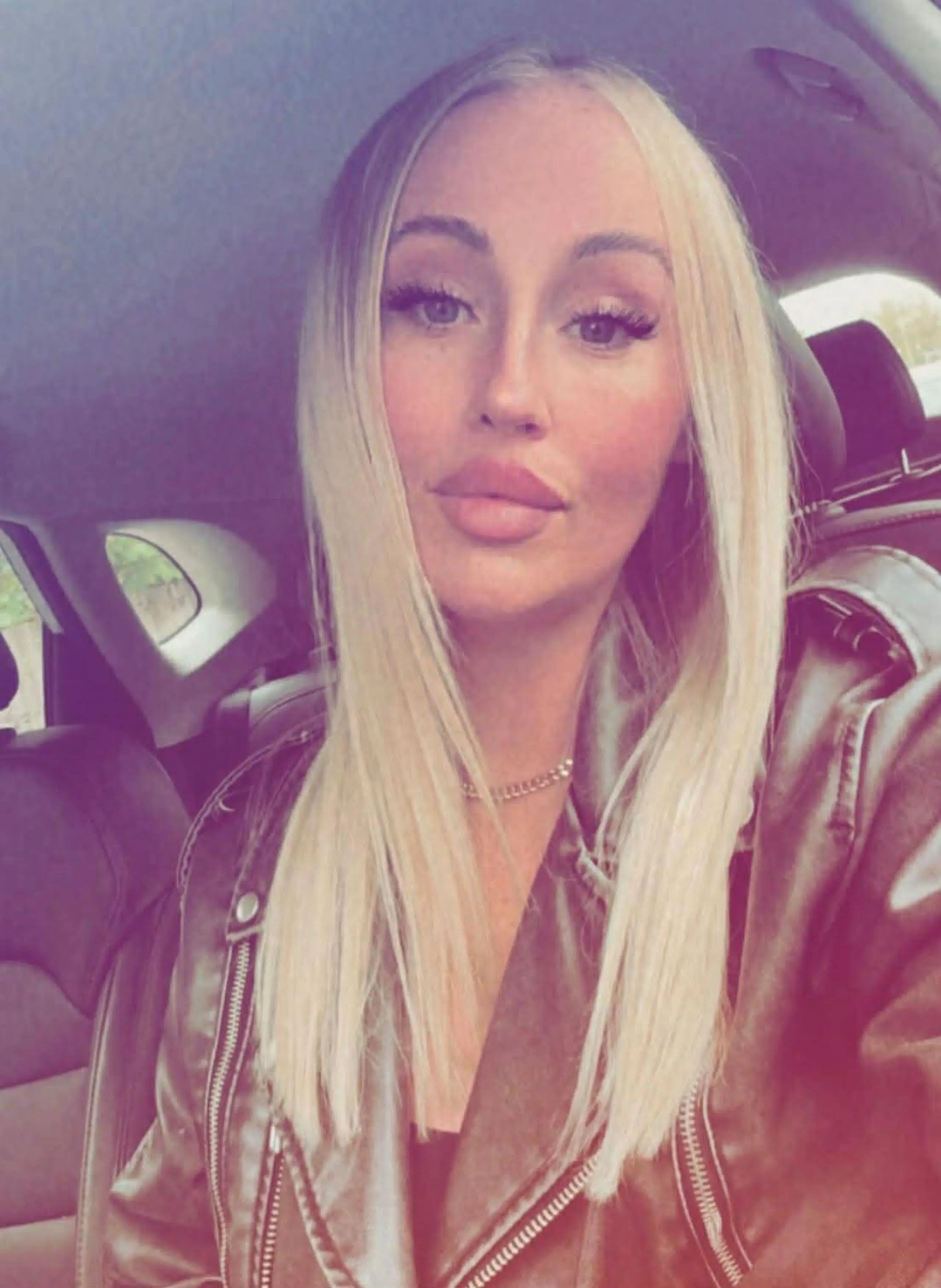 She's hoping to go to the US for 'life-changing' surgery. (Kennedy News and Media)