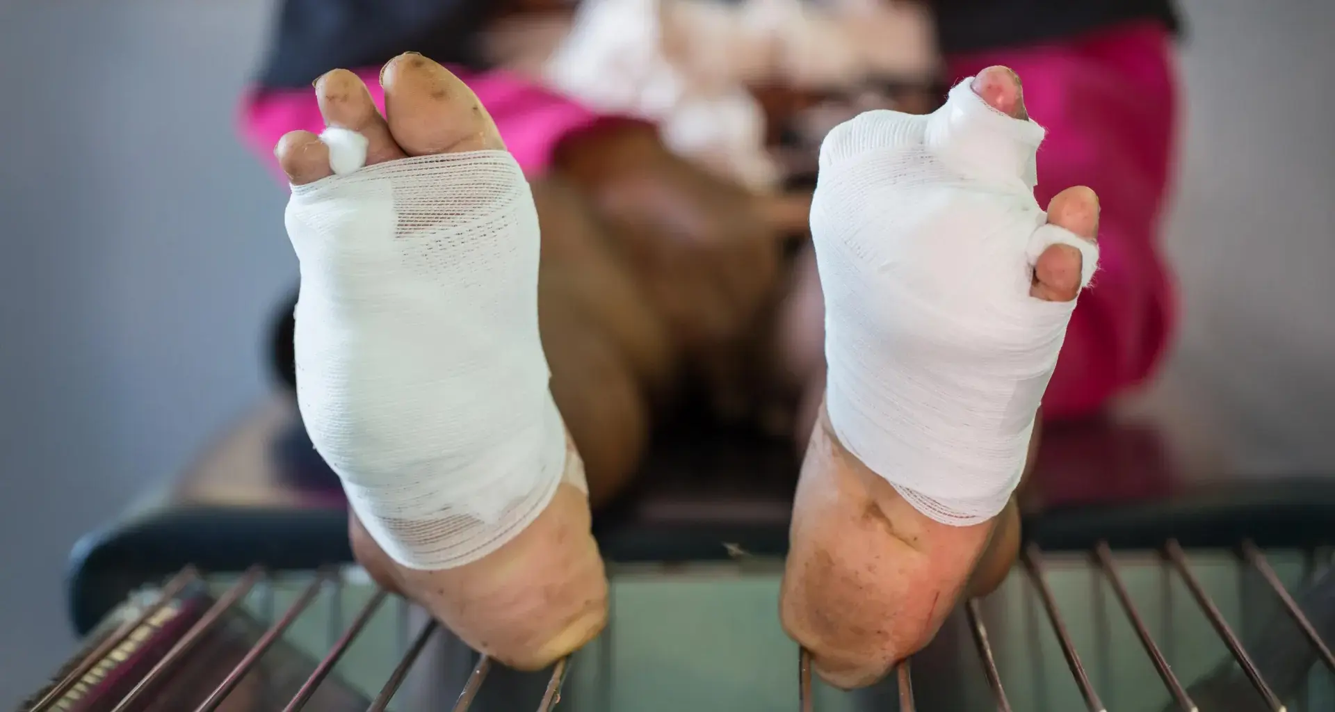 New oxygen gel could prevent amputation in diabetic wound patients