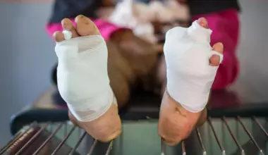 New oxygen gel could prevent amputation in diabetic wound patients