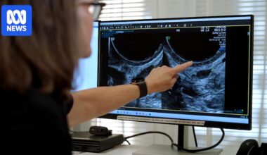 What experts want you to know about endometriosis, diagnosis and surgery as treatment