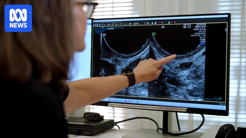 What experts want you to know about endometriosis, diagnosis and surgery as treatment