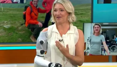 British woman claims she’s 80% human and 20% robot thanks to a mind-reading bionic arm