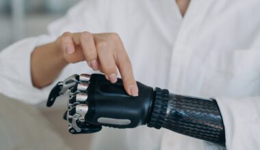 Prosthetic arm blurs the line between machine and human body