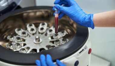 UQ venom-inspired discovery becomes a medical product in Japan - News