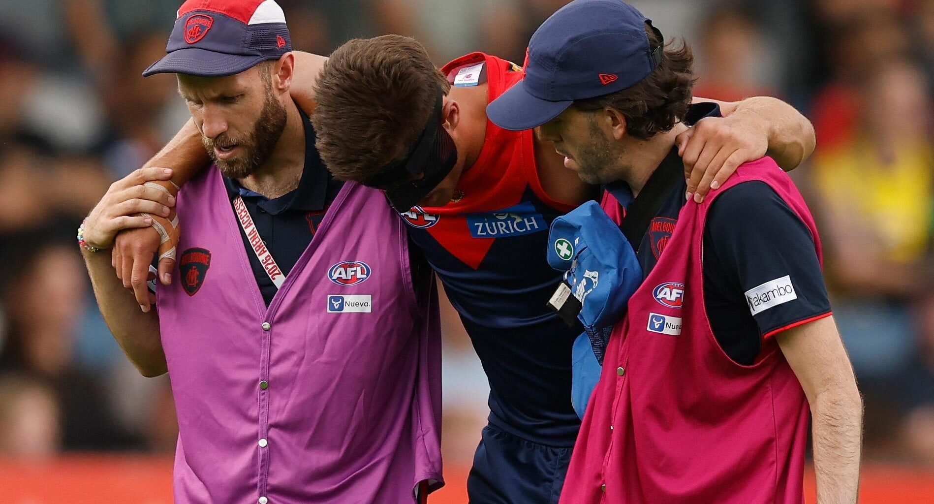 Demon cleared of concussion, sent for scans on knee