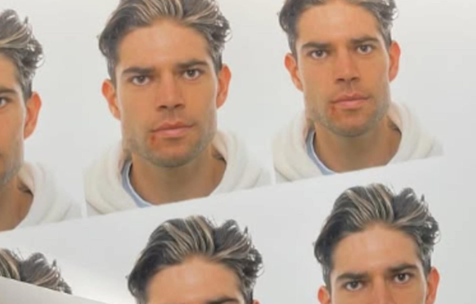 Wout van Aert has lousy news for Omloop Het Nieuwsblad