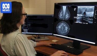 Artificial intelligence detects high breast cancer risk in women given all-clear