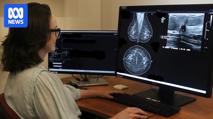 Artificial intelligence detects high breast cancer risk in women given all-clear