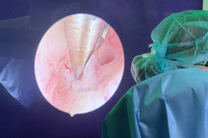 Professor Thierry Vancaillie performs surgery on a patient.