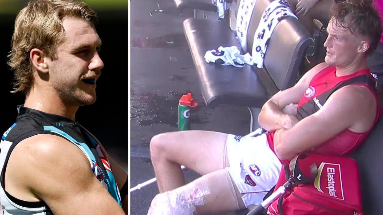 Live AFL 2026, Port Adelaide vs Essendon Bombers Round 2