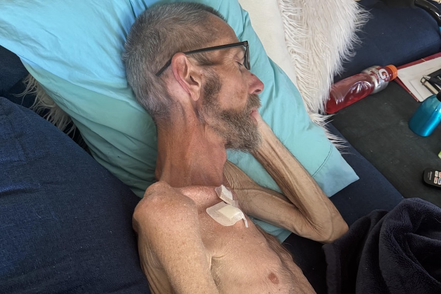 A sick and skinny man sleeping on a pillow on a couch, without a shirt showing his ribs