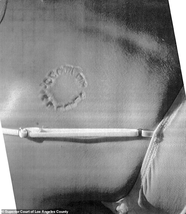 The woman attached this photo of the bite mark allegedly left by Nacua in court documents