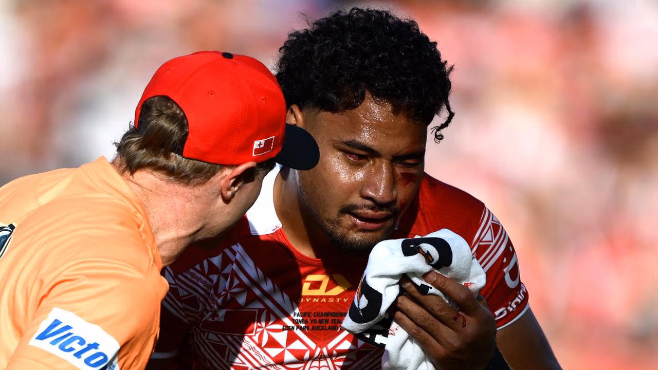 NRL 2026: Craig Bellamy reveals Eliesa Katoa may never play again after horror injury, Melbourne Storm