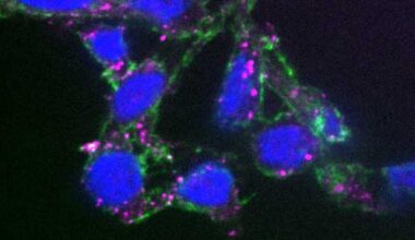 Tumor Molecular Garbage Targeted by Antibody Drugs