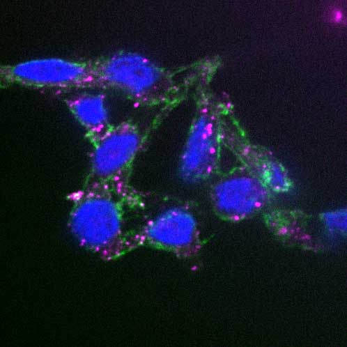 Tumor Molecular Garbage Targeted by Antibody Drugs