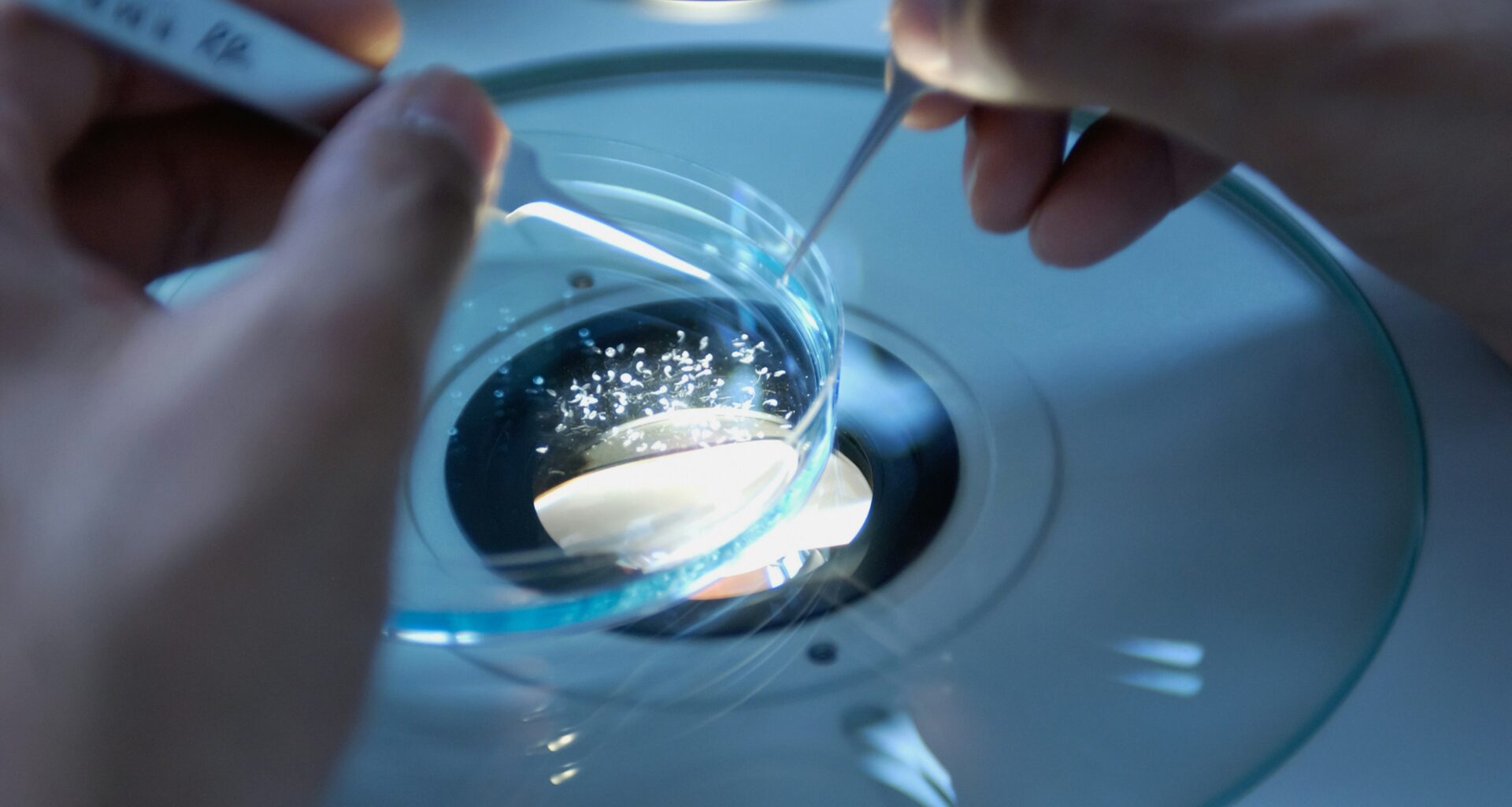 Alzheimer's Proteins Compete Inside Brain Cells