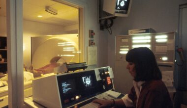 Smoking's Lung Cancer Risk Post Negative CT Scan