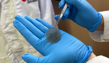 Smart dressing spots infection risk and helps wounds heal