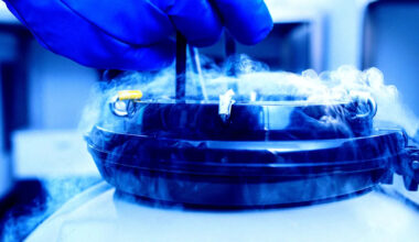 Scientists Bring Mouse Brains Back to Life After “Cryosleep” Deep Freeze