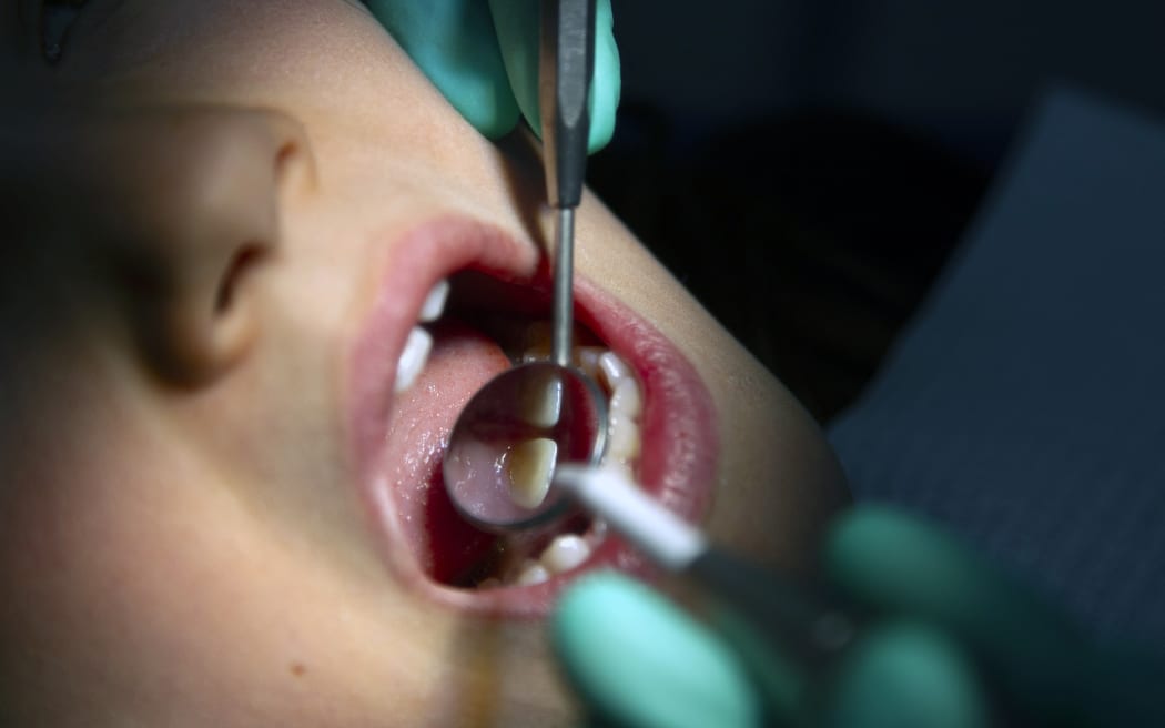 France, Hautes-Alpes, Briancon, 2023-06-28. A dentist provides dental care to a little girl, illustration of the profession of dental surgeon who is a health professional specializing in the management of pathologies of the teeth and gums. Photography by Thibaut Durand / Hans Lucas.
France, Hautes-Alpes, Briancon, 2023-06-28. Une dentiste prodigue des soins dentaires a une petite fille, illustration du metier de chirurgien-dentiste qui est un professionnel de la sante specialise dans la prise en charge des pathologies des dents et des gencives. Photographie par Thibaut Durand / Hans Lucas. (Photo by Thibaut Durand / Hans Lucas via AFP)