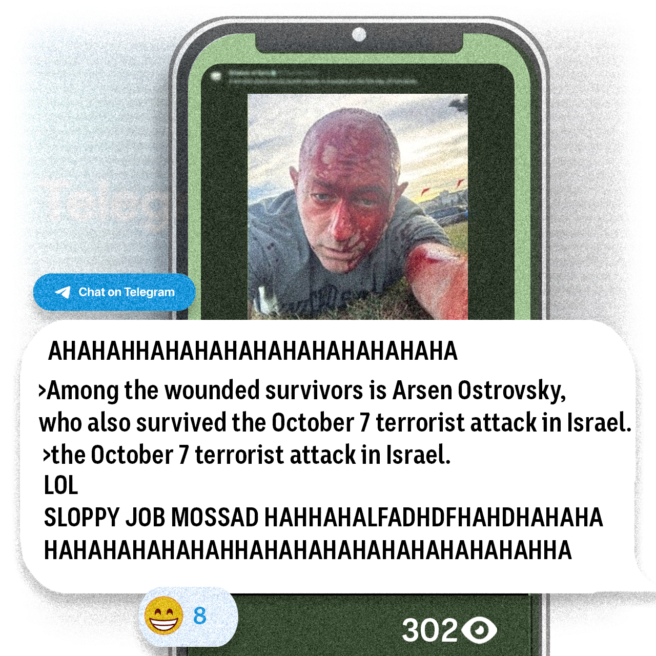 A phone screen showing a selfie of a man with blood on his face. A message suggests Mossad was involved in the attack.