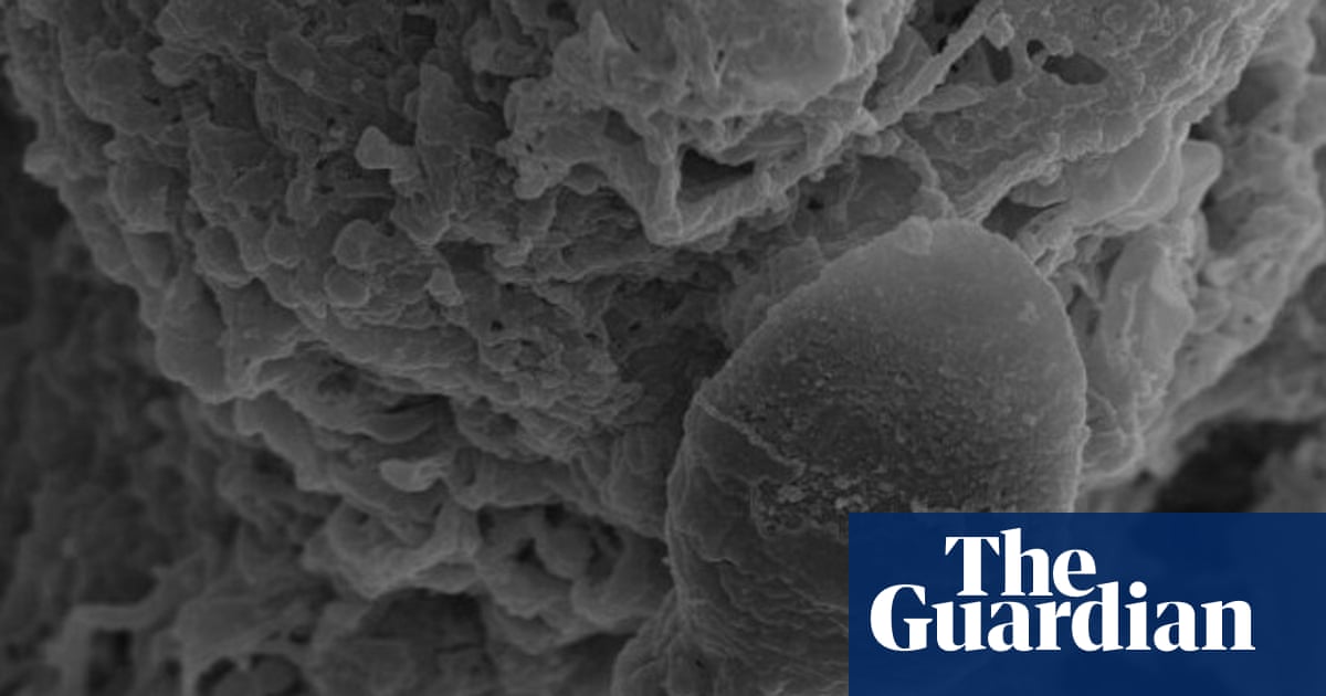 Sperm get lost in space, Australian research into microgravity impacts suggests | Space