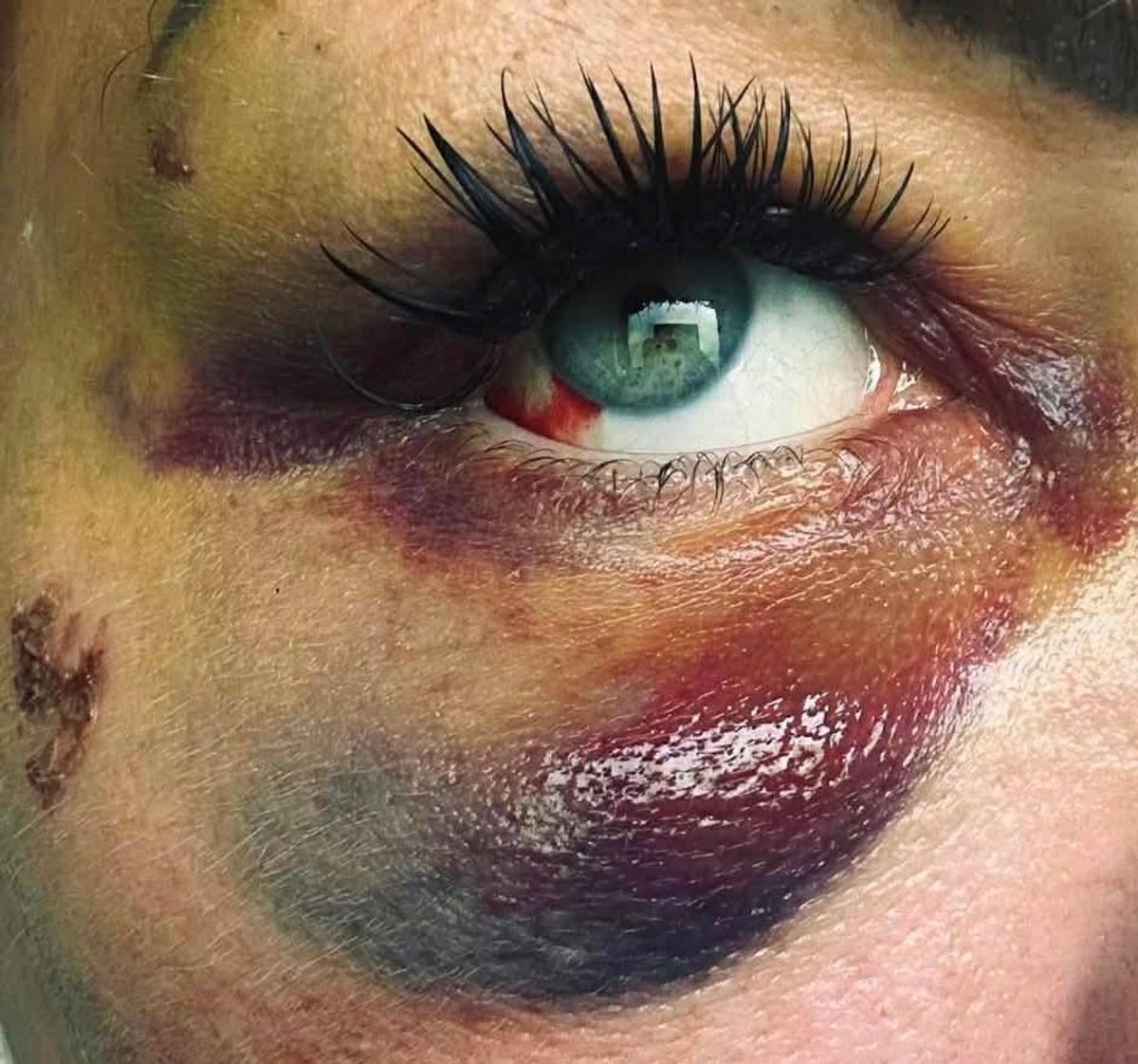 The brave mum-of-two hopes to raise awareness around gender based violence. 