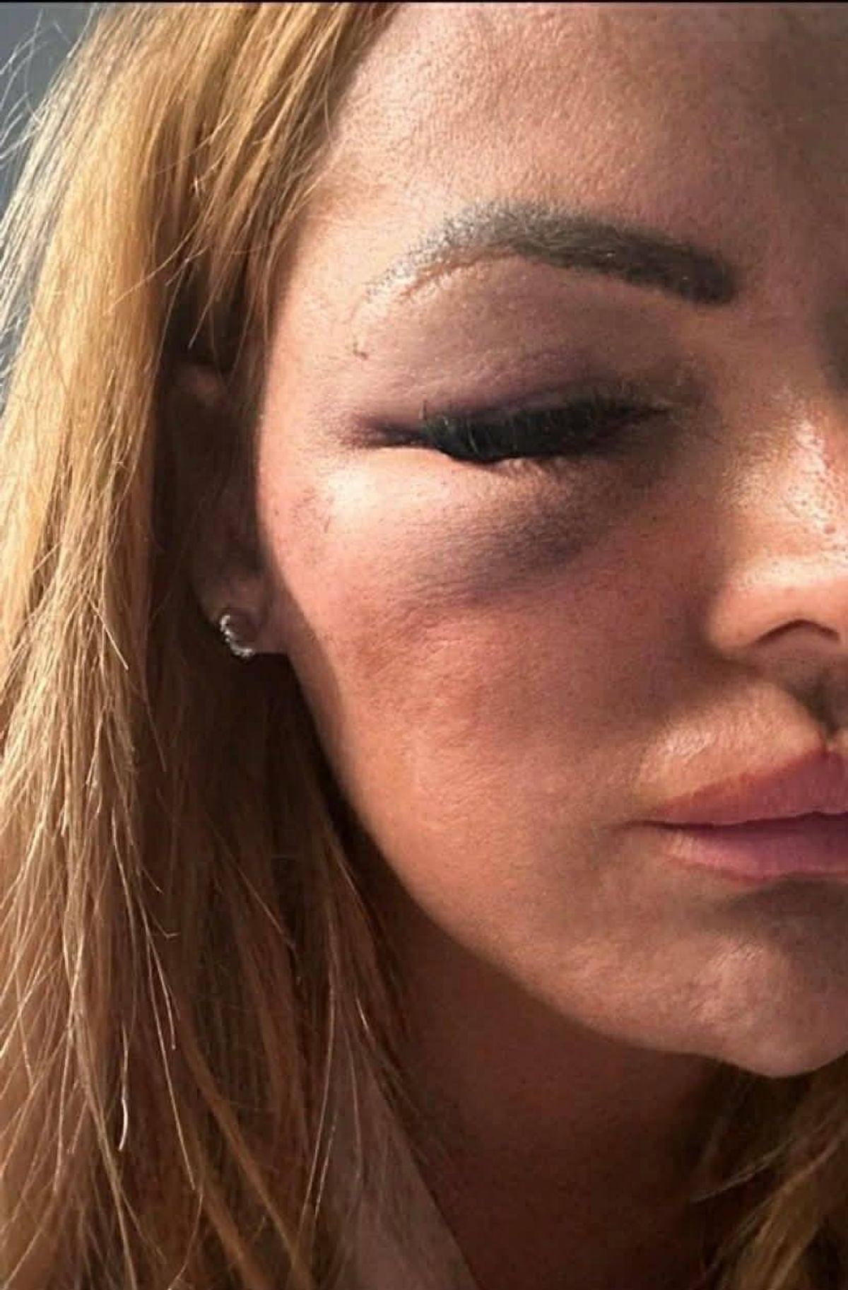 Anne Marie was on a night out with her cousin when she was attacked. 