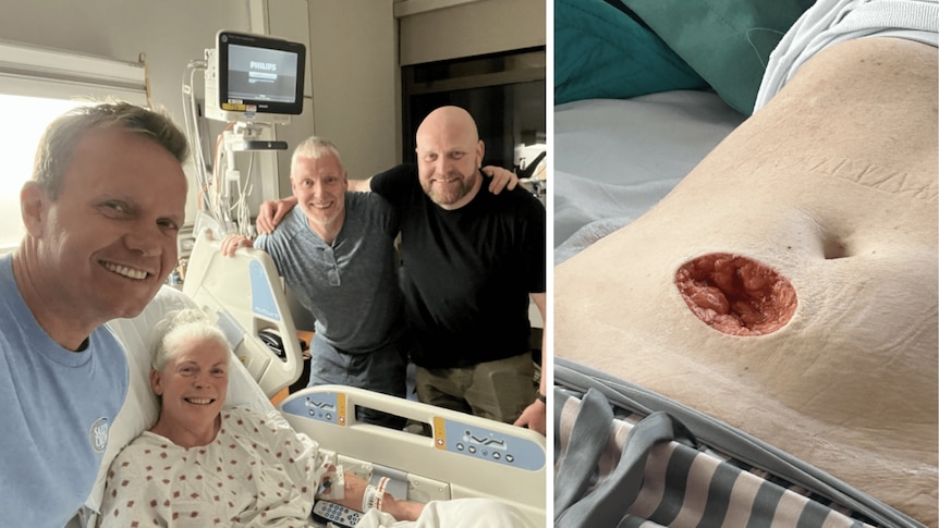 Composite: woman in hospital bed; stomach with a circular chunk removed, showing red tissue