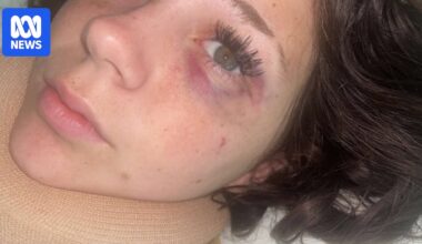 14-year-old Liarna Peters speaks out after violent attack at Kiama beachside party