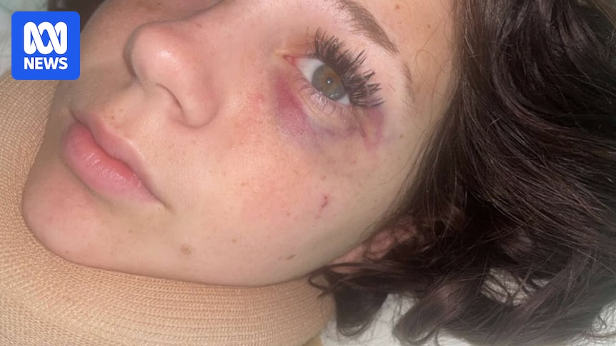14-year-old Liarna Peters speaks out after violent attack at Kiama beachside party