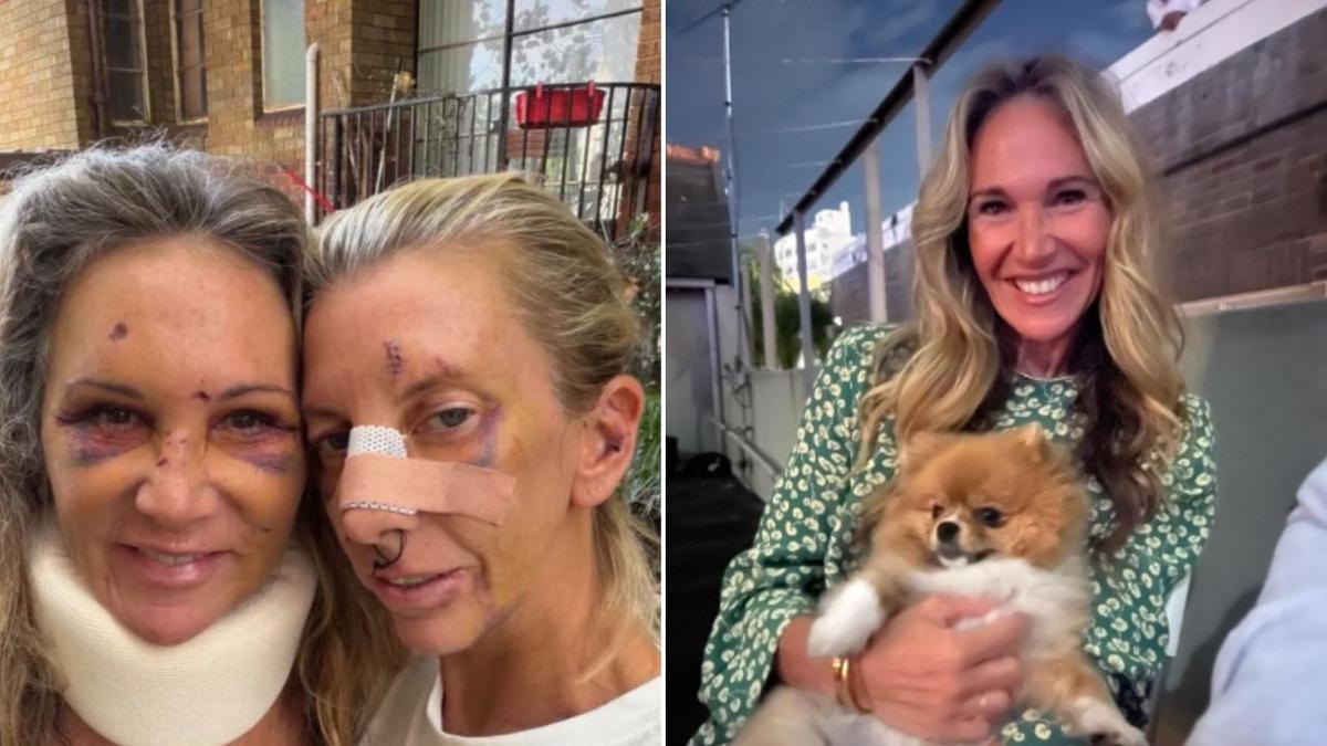 Women brutally attacked by disgraced Sydney dentist who was shot dead by police in Potts Point reveal injuries