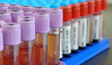 AI can determine time of death from a single blood sample