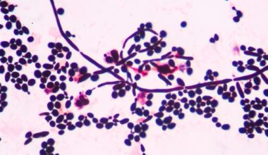 New catalog identifies dozens of plasma membrane repair proteins