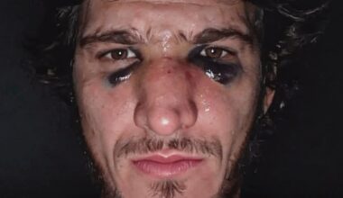 Movsar Evloev broke nose weeks before UFC London win